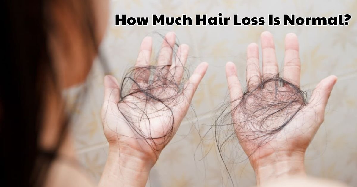 How Much Hair Loss Is Normal The Complete Guide to Daily Shedding