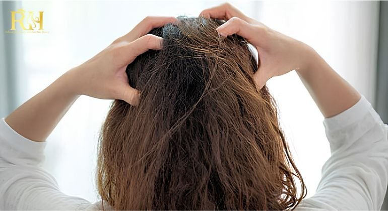 Scalp Irritation