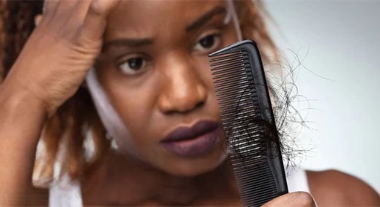 What Causes Wig Shedding