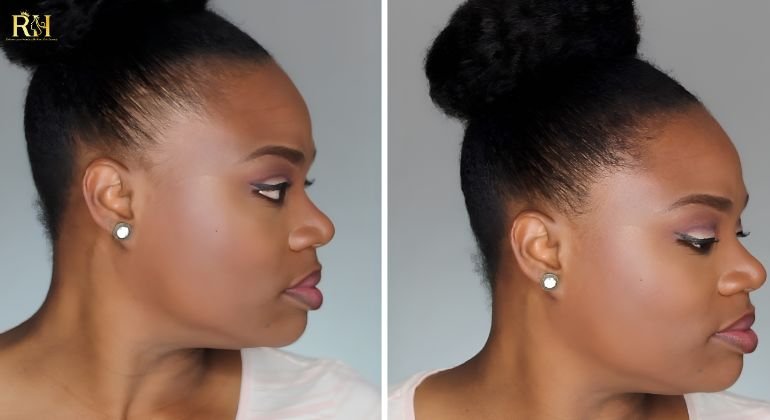 Protect Your Edges Hairline Health Comes First