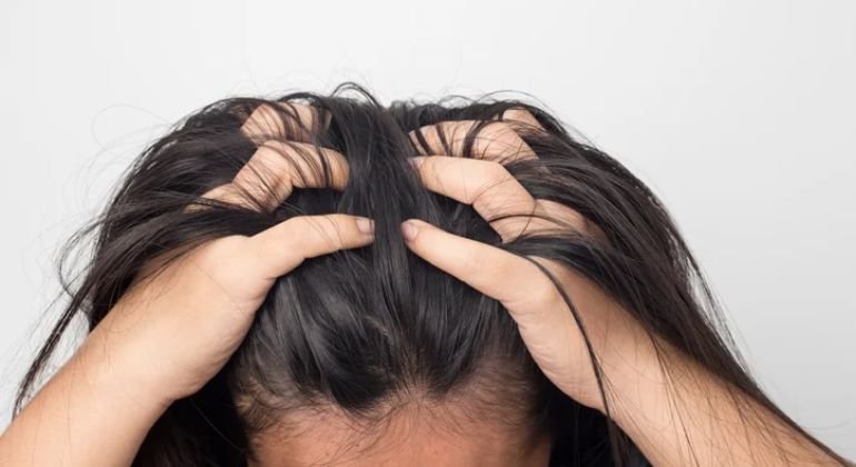 Fix Winter Scalp Care First