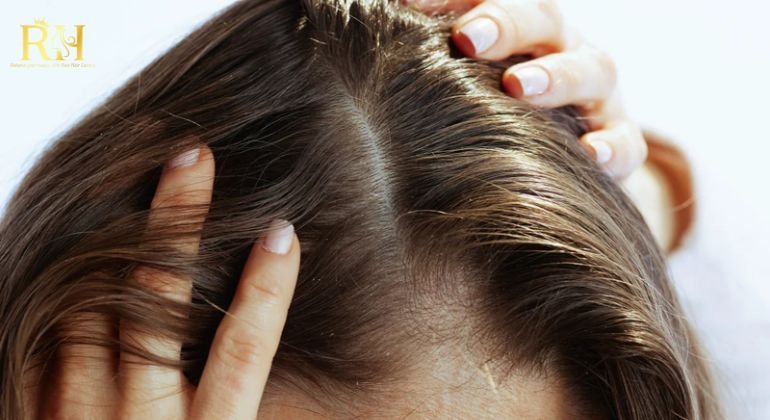 Protect Your Scalp from UV Exposure
